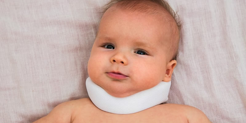 Torticollis